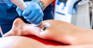 Regenerative Therapy